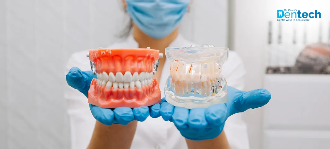 Dentures Treatment in Powai at Dr. Karve's Dentech