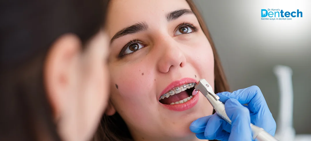 Orthodontic Treatment in Thane at Dr. Karve's Dentech