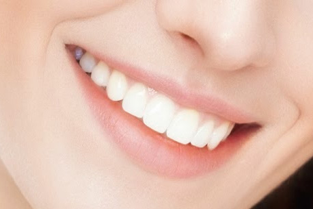 Best cosmetic smile design treatment in Powai and thane