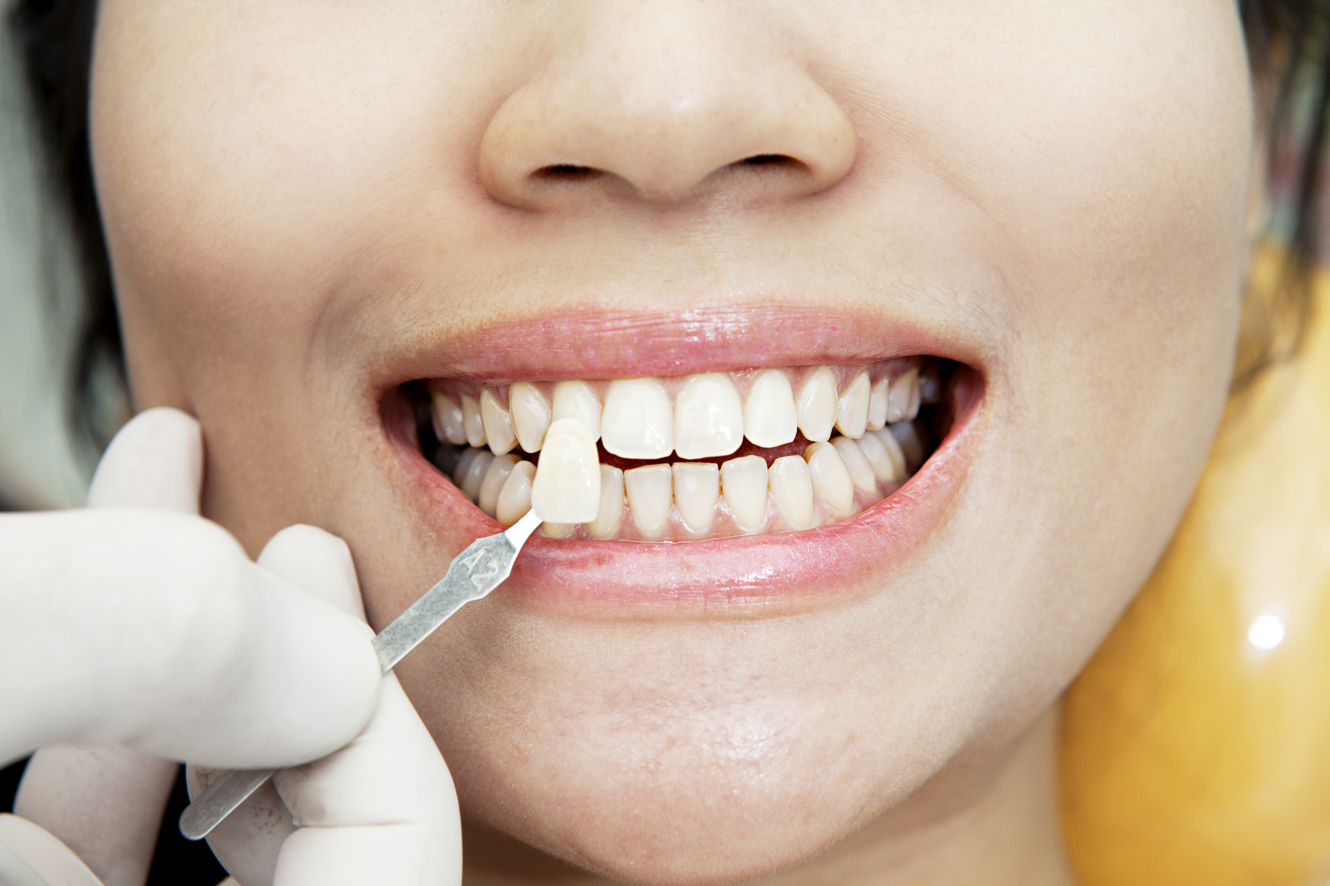 SMILE DESIGN