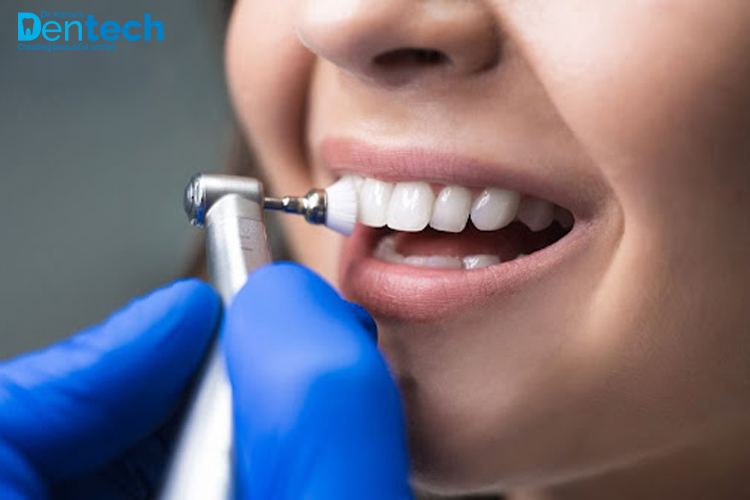 Confused Between Teeth Cleaning and Teeth Whitening