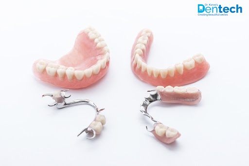 partial dentures cost india