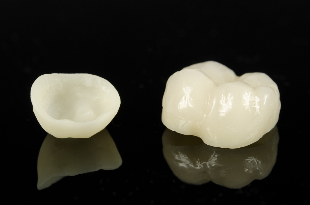 All-Ceramic Dental Crowns - Dentech