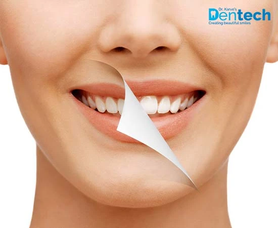 Smile Designing Treatments Cost In Powai