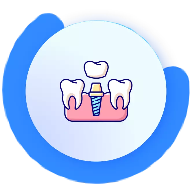Dental Implants in thane