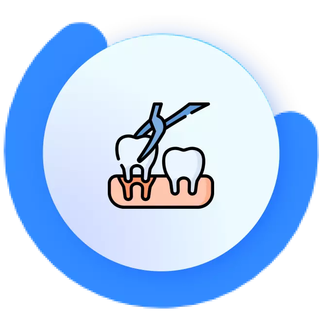 Dental Extractions in powai