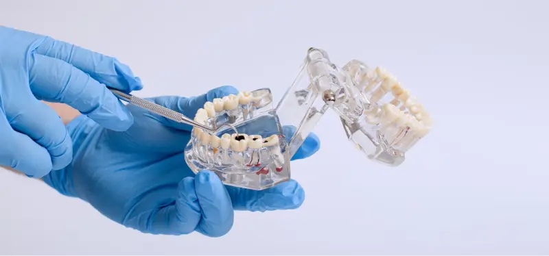 Dentures