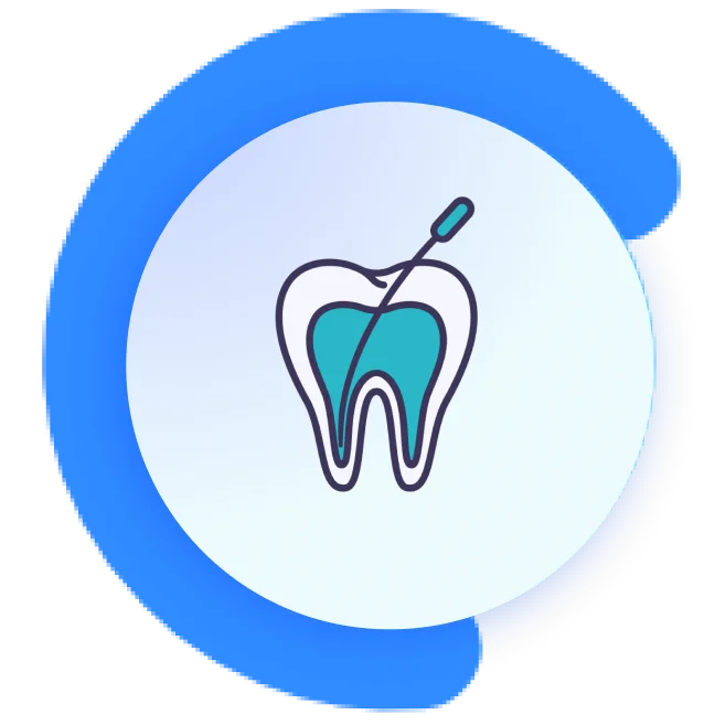 Root-Canal-Treatment